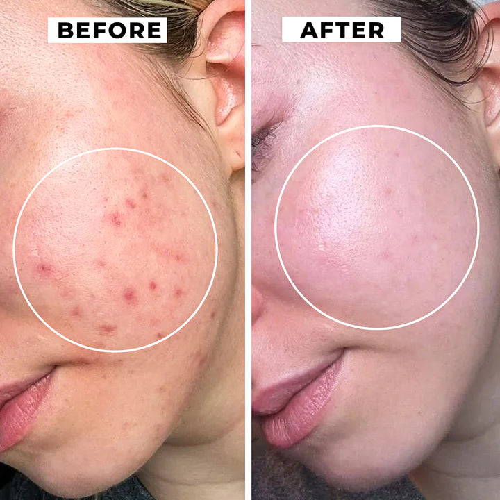 Decimal Advanced Skin Whitening Cream