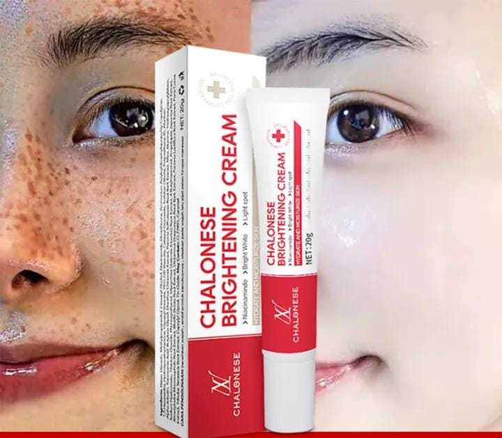 CHALONESE Brightening Cream گر 7 دن میں نتائج نہ ملیں تو مکمل رقم واپس