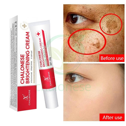 CHALONESE Brightening Cream گر 7 دن میں نتائج نہ ملیں تو مکمل رقم واپس
