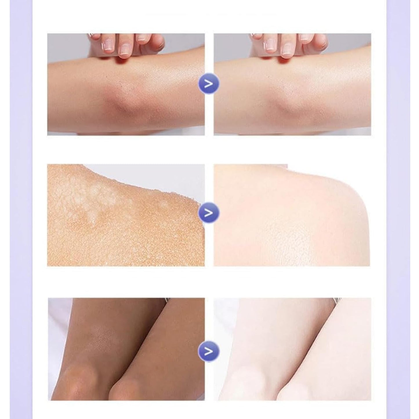 Omenfee Cold White Skin Cream (Buy 1 Get 1 Free)