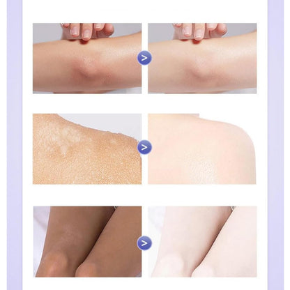 Omenfee Cold White Skin Cream (Buy 1 Get 1 Free)