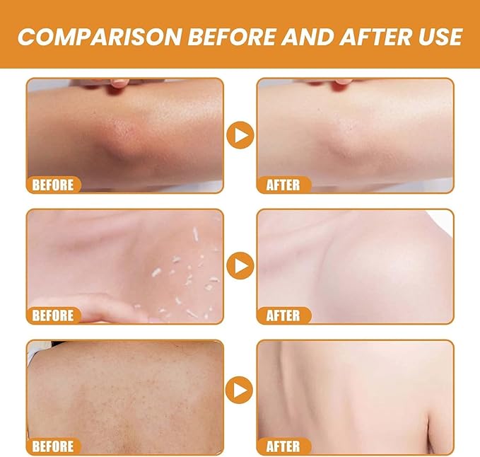 Orange Exfoliating Brightening Gel (Original)