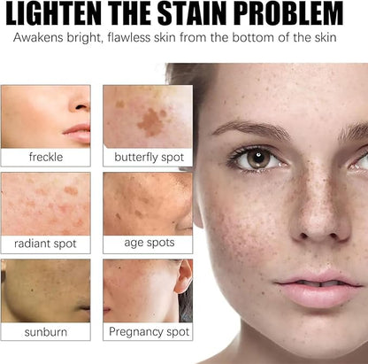 Ezrch Spot Fading Urea Cream