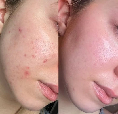 Decimal Advanced Skin Whitening Cream