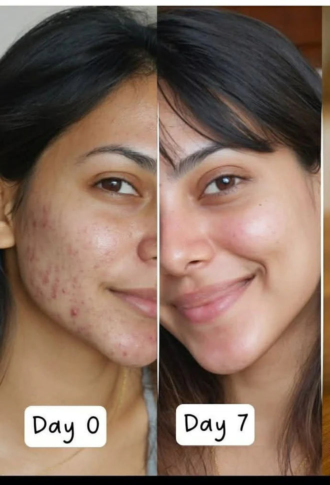 Decimal Advanced Skin Whitening Cream