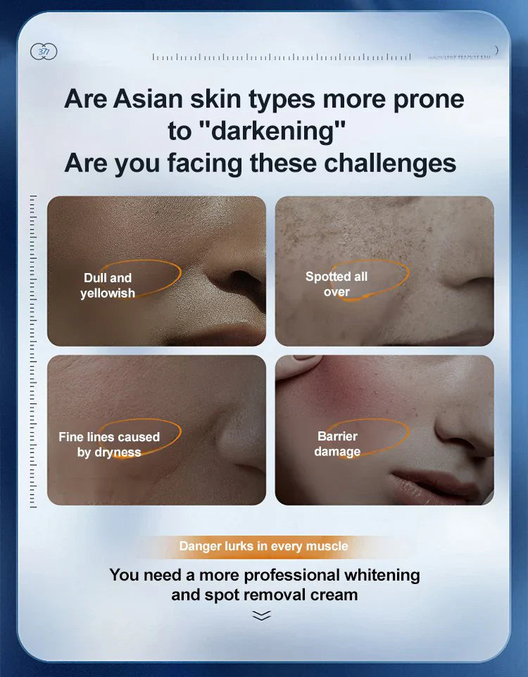 Ezrch Spot Fading Urea Cream